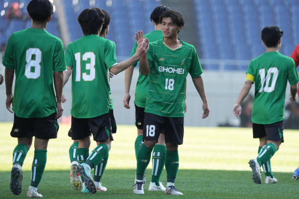 买断条款也